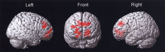  非侵襲脳活動計測(fMRI)データから確率的推論にかかわる脳部位を抽出した。高次元でノイズの多いデータから有意な情報を抽出し、知性と生命の機能を探る。